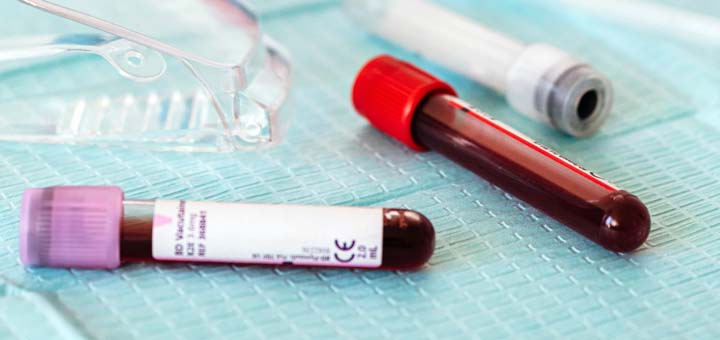 Blood tests can be used to find out hemoglobin levels - Photo by Karolina Grabowska from Pexels