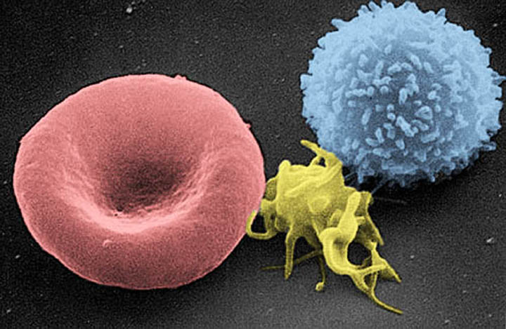 Glóbulo vermelho e  linfócito - Electron Microscopy Facility at The National Cancer Institute at Frederick (NCI-Frederick), Public domain, via Wikimedia Commons