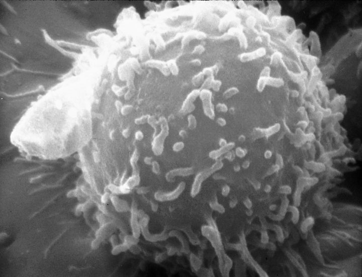 A Lymphocyte, which is a subgroup of leucocytes in the human immune system. 