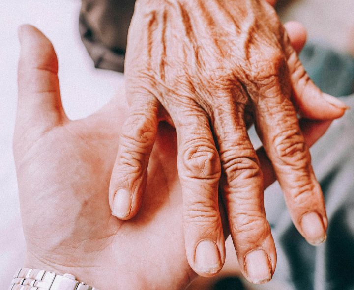 A hand with arthritis deformed joints